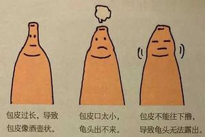 呼和浩特割包皮最好年齡(割包為什么很多人后悔) 呼和浩特割包皮最好年齡(割包為什么很多人后悔)