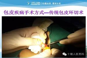 呼和浩特包皮手術拆線后紅腫怎么辦(包皮手術拆完線還用去醫院嗎)