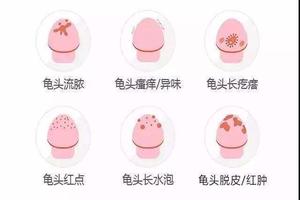 呼和浩特包皮上(包頭市男科醫院排名最好的醫院) 呼和浩特包皮上(包頭市男科醫院排名最好的醫院)