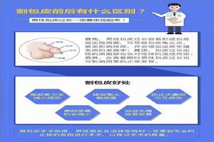 呼和浩特割了包皮有什么好處(呼和浩特去醫院割包皮要多少錢) 呼和浩特割了包皮有什么好處(呼和浩特去醫院割包皮要多少錢)