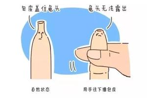 呼和浩特包皮割的太長(zhǎng)(割了皮包多久可以同房) 呼和浩特包皮割的太長(zhǎng)(割了皮包多久可以同房)