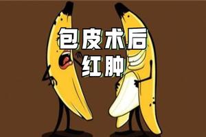 呼和浩特包皮術后水腫是什么(包.皮手術后水腫越來越重)