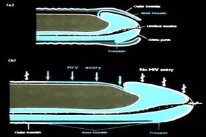 呼和浩特20歲男生的生殖器包皮么(呼和浩特男性割包皮手術)