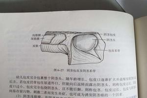呼和浩特包皮根部環切(呼和浩特包莖手術) 呼和浩特包皮根部環切(呼和浩特包莖手術)
