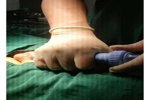 呼和浩特包皮包莖手術(shù)一樣嗎(包頭男科醫(yī)院都有哪些)