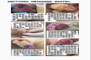 呼和浩特割包皮幾天才能好(呼和浩特市割包皮多少錢) 呼和浩特割包皮幾天才能好(呼和浩特市割包皮多少錢)